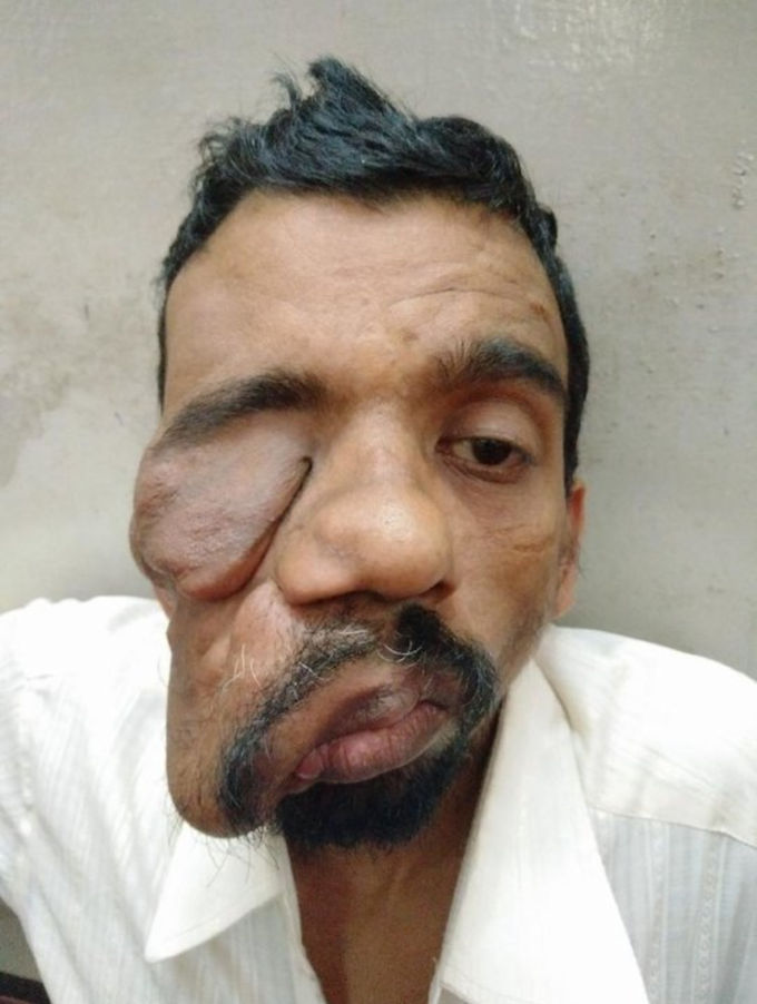 Spot Diagnosis ??