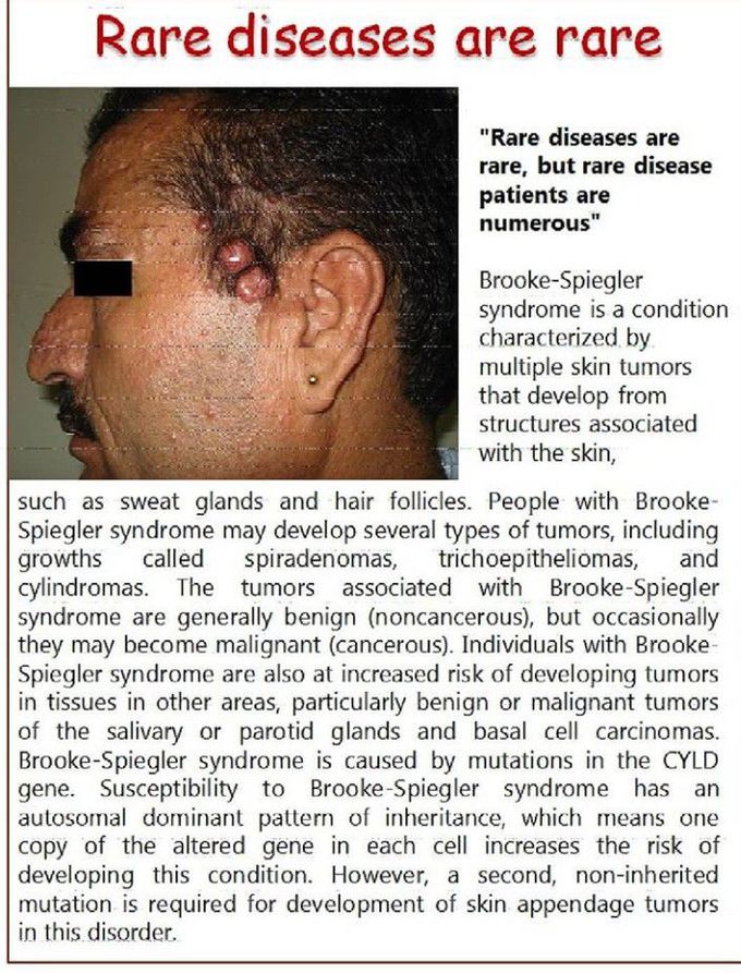 Rare disease