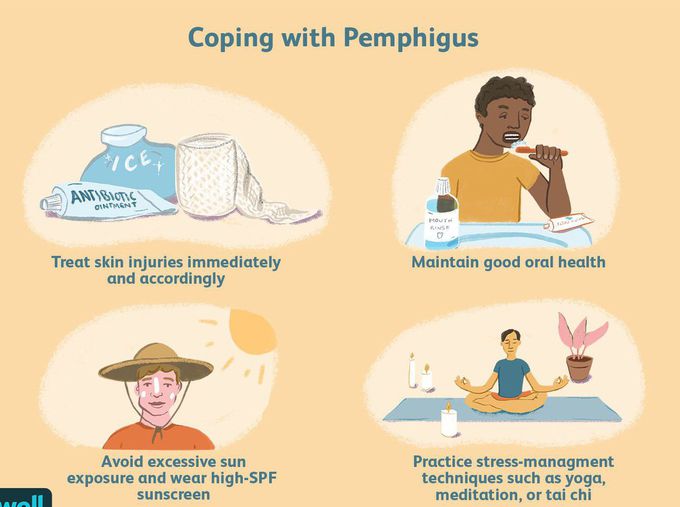 Treatment of pemphigus vulgaris