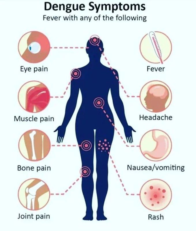 Dengue Symptoms