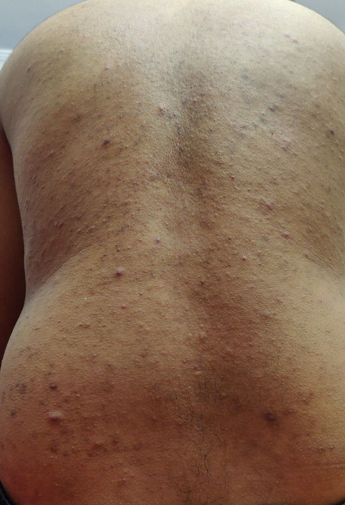 Diagnosis and treatment?