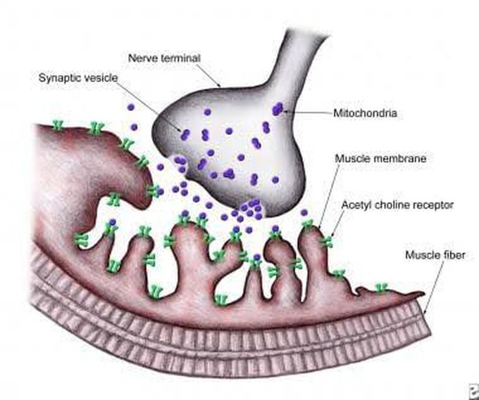 Causes of myasthenia gravis