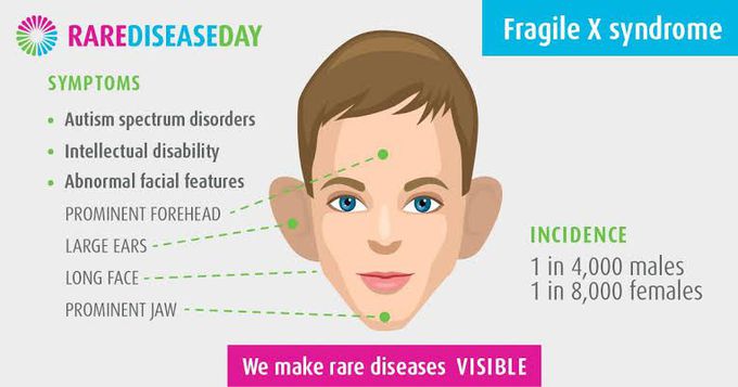 Symptoms of fragile X syndrome