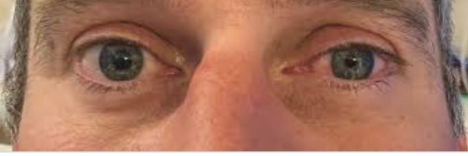 Diagnosis?