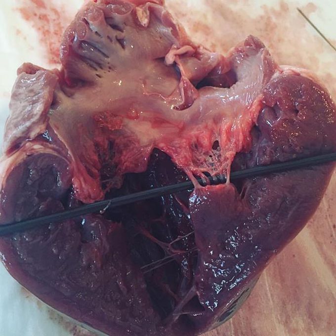 This is how amazing the heart is