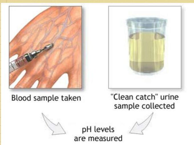 URINE pH??