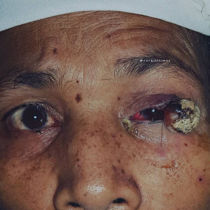 Medical case