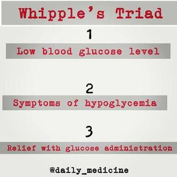 Whippl's Triad in diagnosis of hypoglycemia