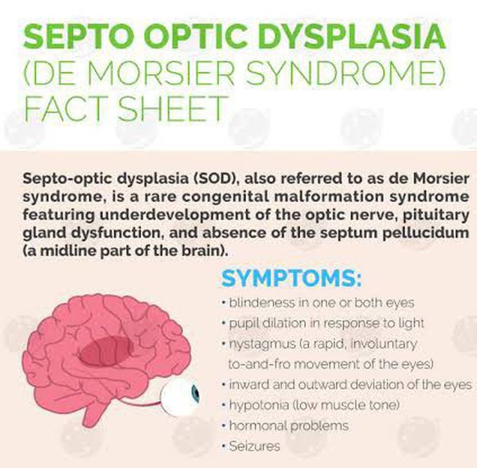 These are the symptoms of Septo optic dysplasia syndrome