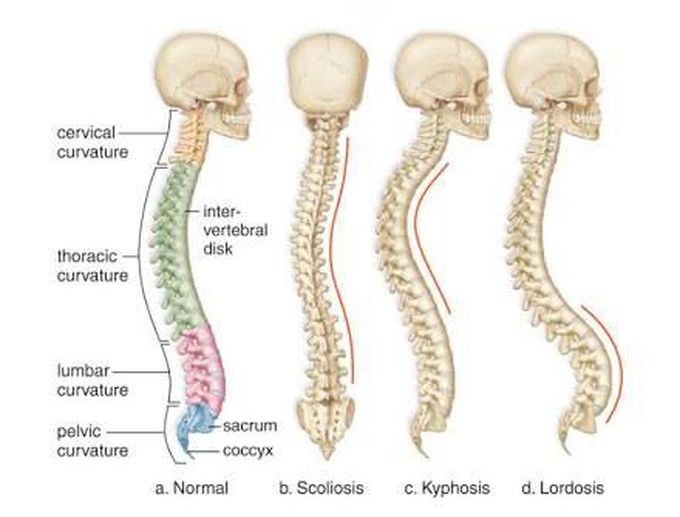 Types of spinal deformities