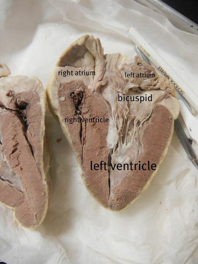 HEART DISSECTION