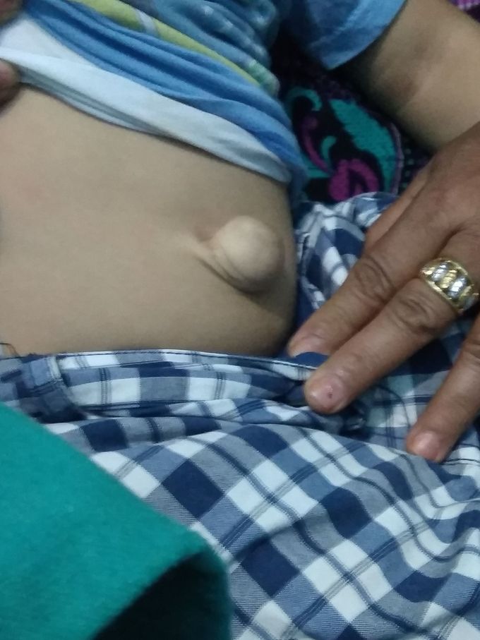 What is the diagnosis???