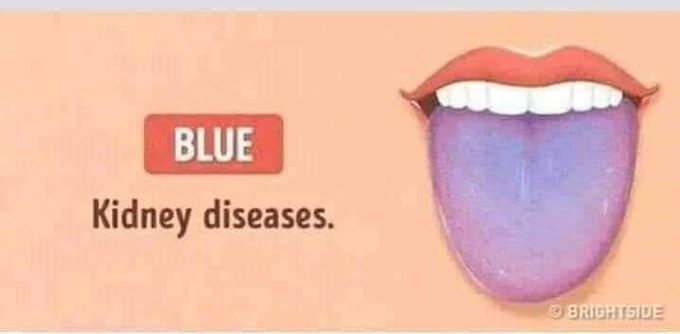 Kidney diseased