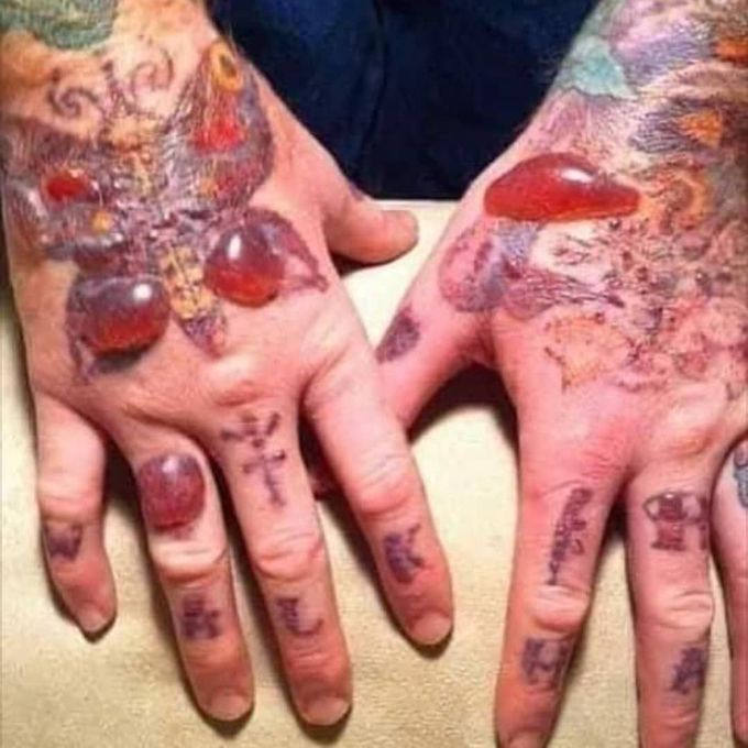 Always make sure you aren't allergic before getting any tattoos