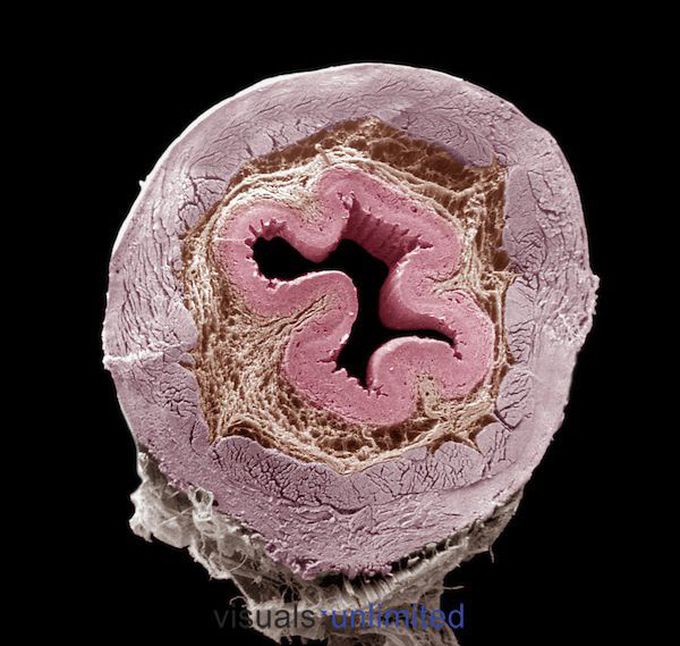 Esophagus cross-section