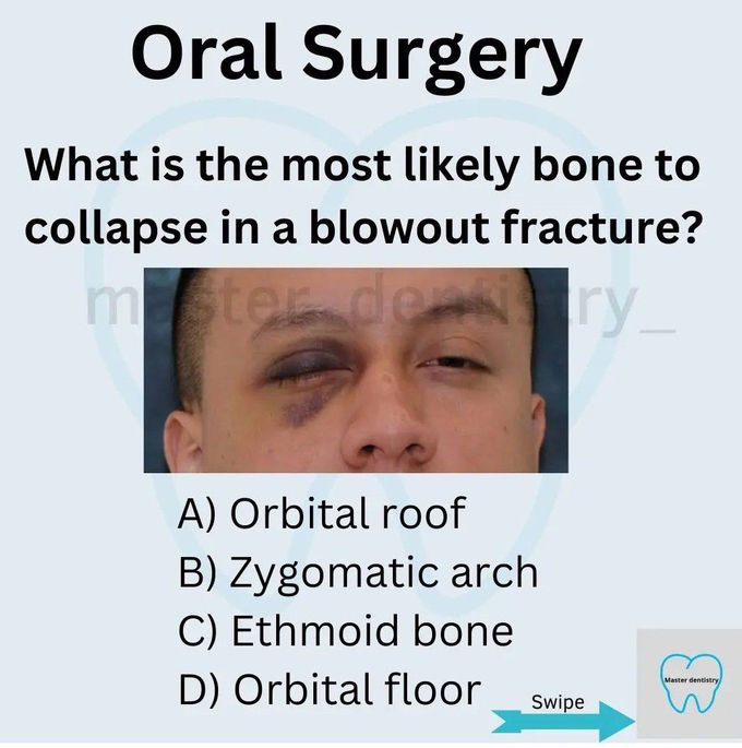 Blowout Fracture