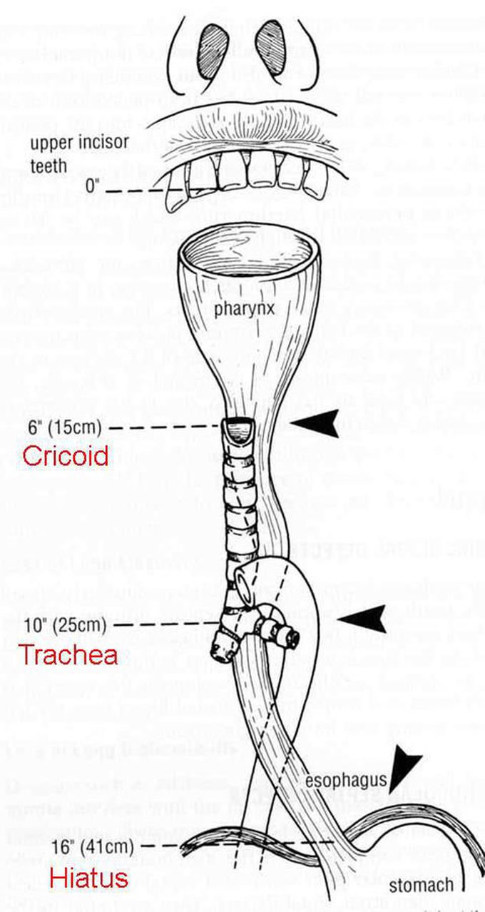 Esophagus