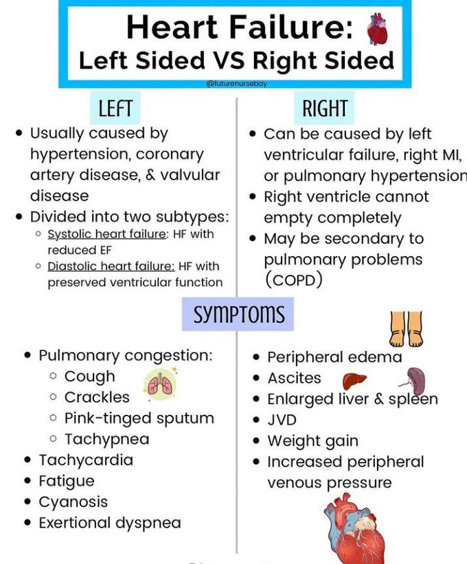 Heart failure ( Left side vs right side )