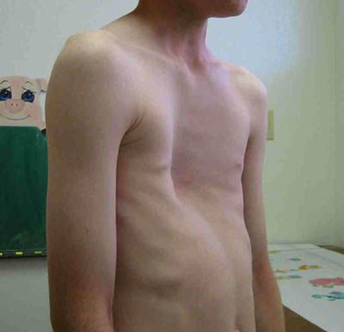 What's your diagnosis??