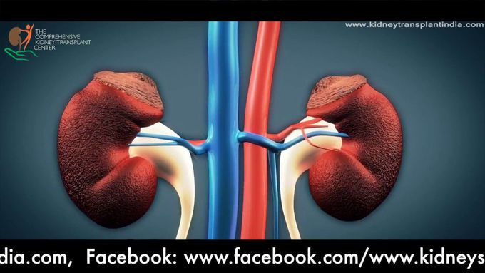 Kidney Transplantation: Animation of Surgical steps as performed by Dr. Priyadarshi Ranjan