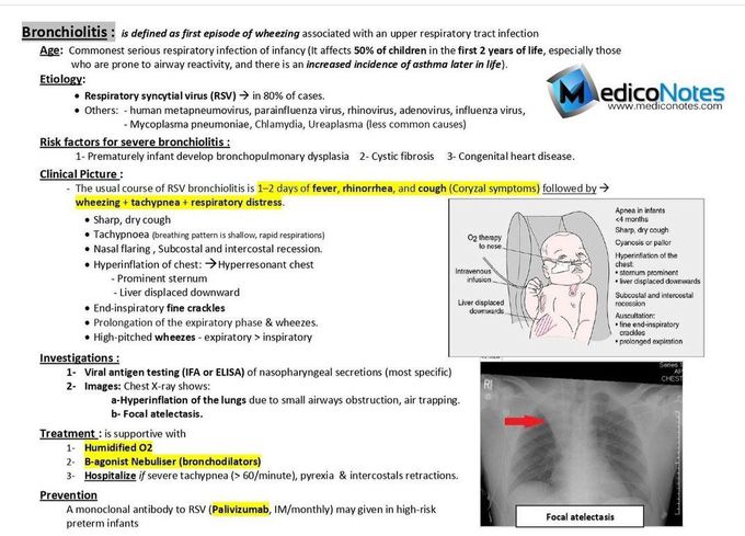 Bronchiolitis