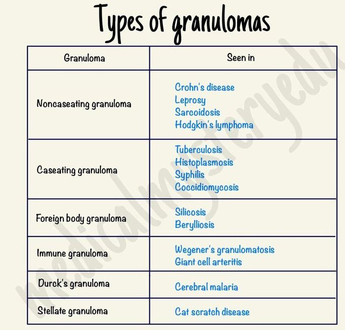 Types of Granulomas