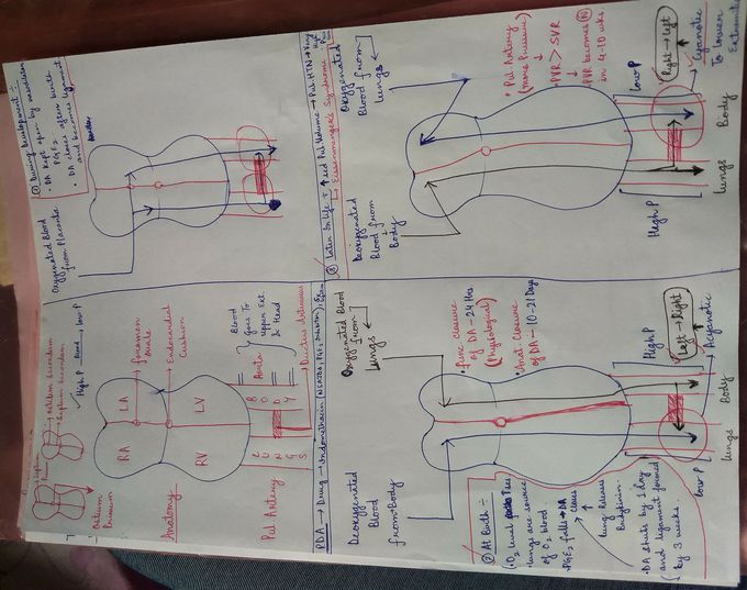 Paediatrics CHD