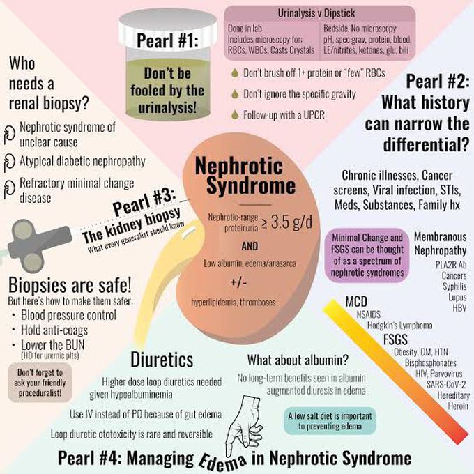 Causes of nephrotic syndrome