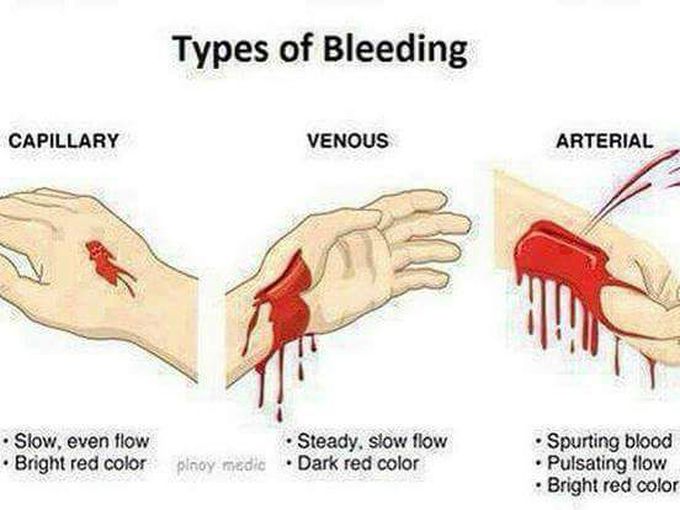 Types of bleeding