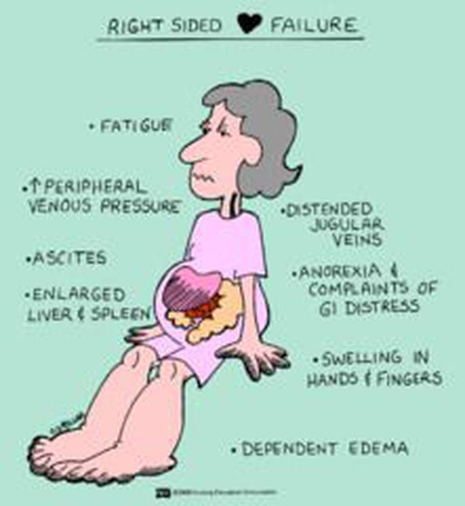 Pin by Grace Walzel on DIY | Medical surgical nursing, Nursing school survival, Surgical nursing