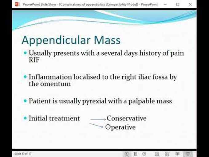 Appendicitis: Complications