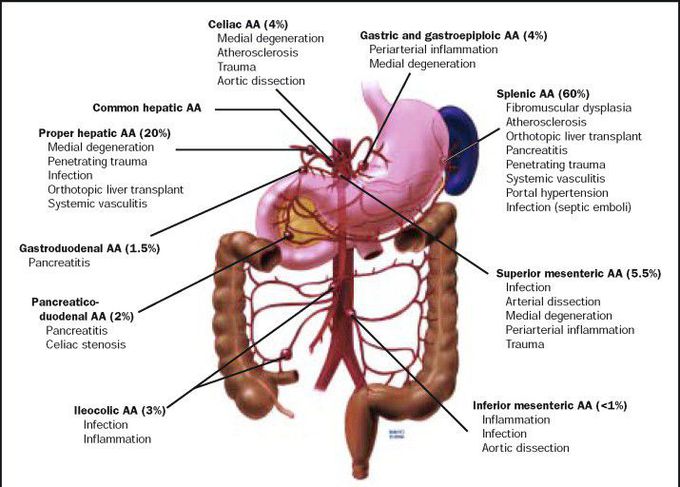 Symptoms of splenic artery aneurysm