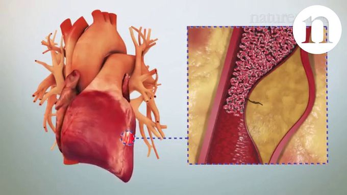 The evolution of oral anticoagulants