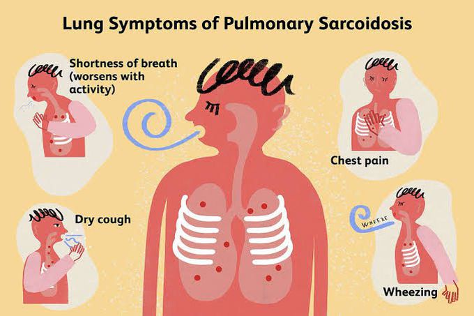 Sarcoidosis symptoms