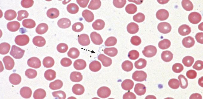 Borrelia hermsii (Relapsing Fever)