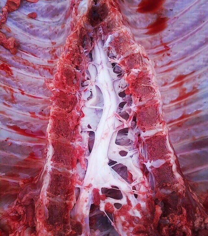 Spinal cord