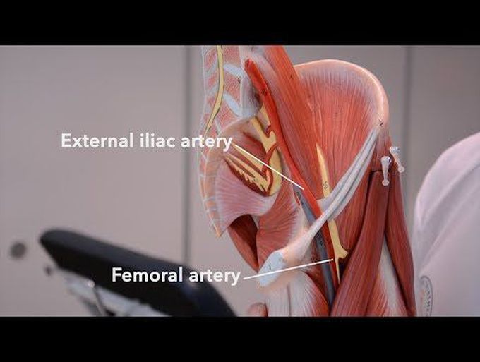 An in-depth discussion on the arteries of the lower limb
