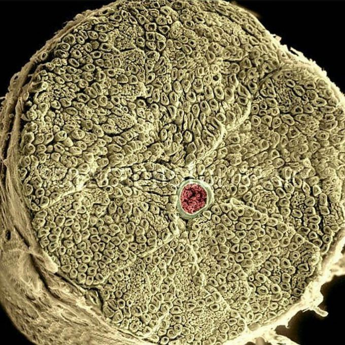 Scanning electron microscopy (SEM) of the human spinal cord and dorsal root ganglia