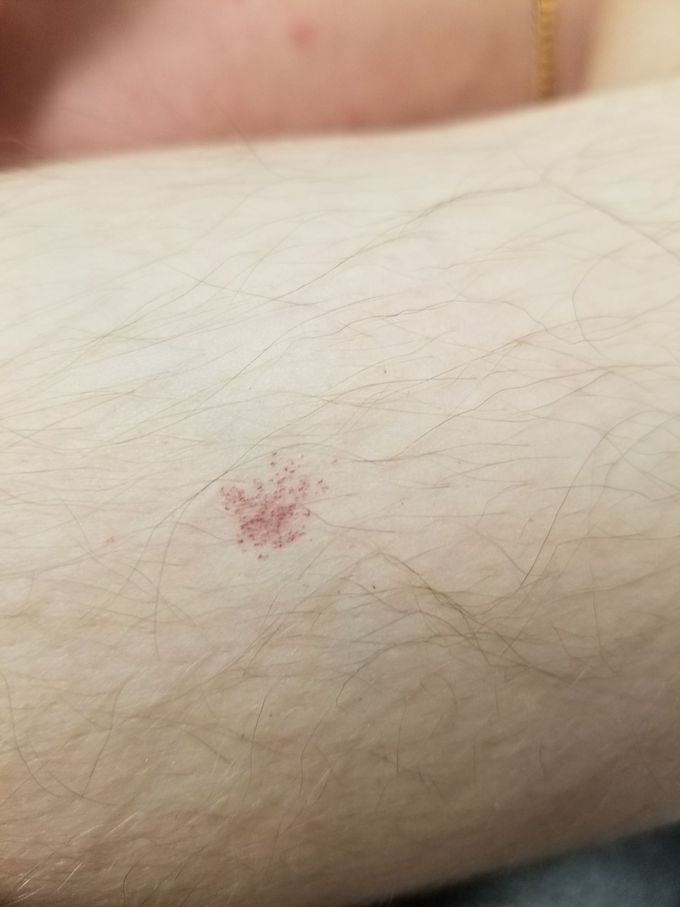 Diagnosis ?