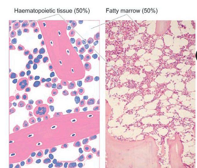 Normal bone marrow