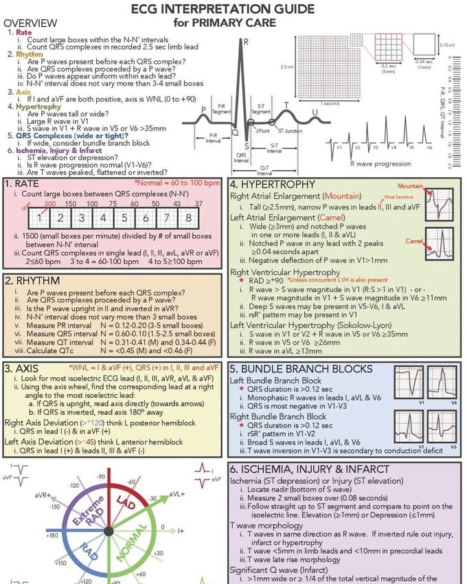 ECG Interpretation Guide