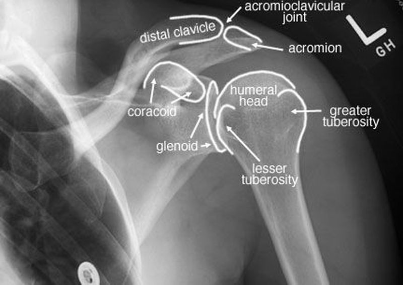 internal rotation shoulder xray