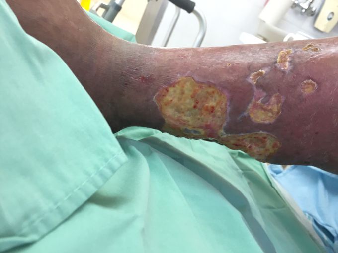 What is your diagnosis??