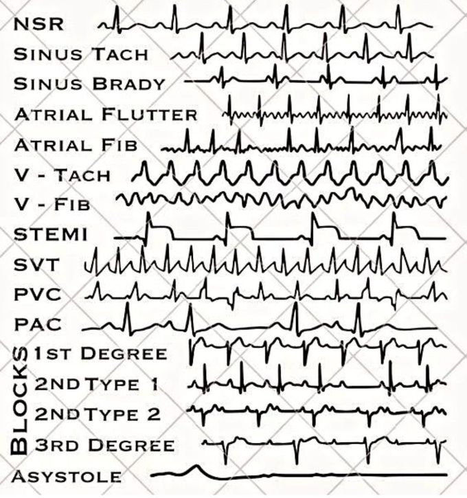 Common Rhythms