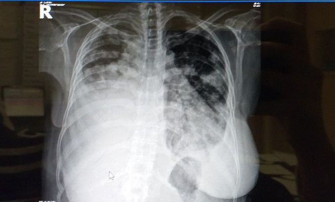What is your diagnosis?