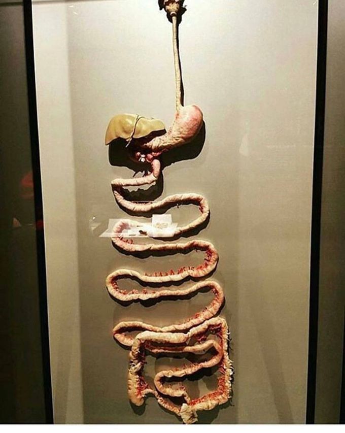 Gastrointestinal Tract