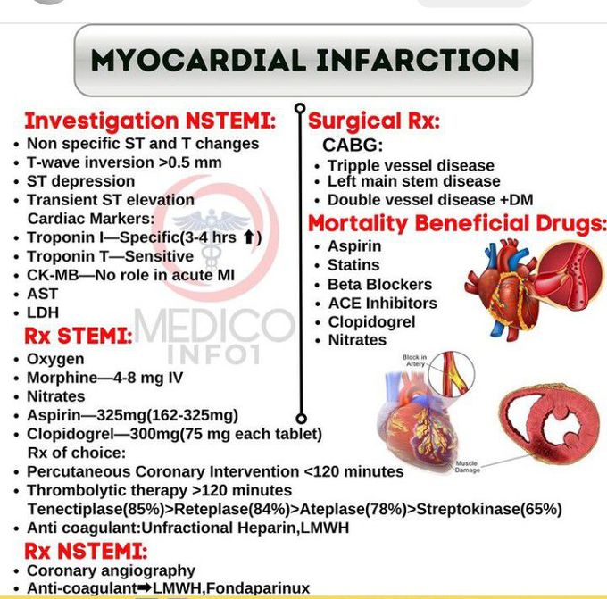 Myocardial Infarction