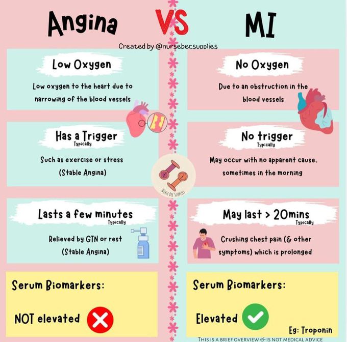 Angina Vs MI