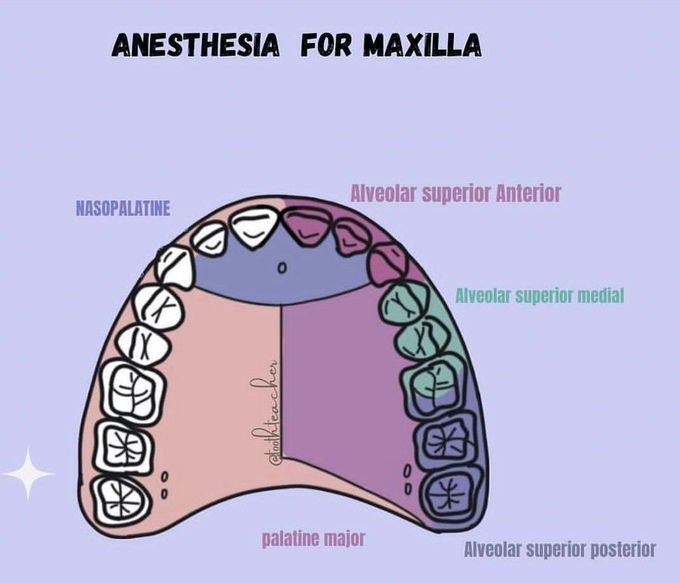 Anesthesia for Maxilla