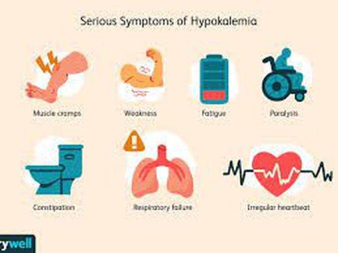 Symptoms of hypokalemia